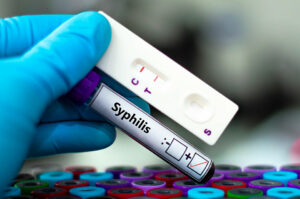 Syphilis testing tube and test strip, used for detecting Treponema pallidum, the bacteria that causes syphilis