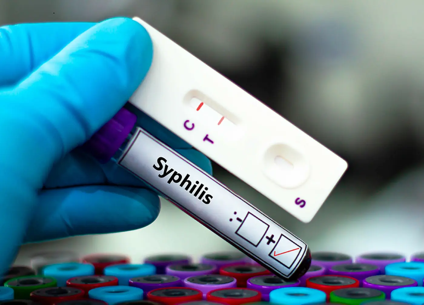 Close up shot of a gloved hand holding a syphilis test.