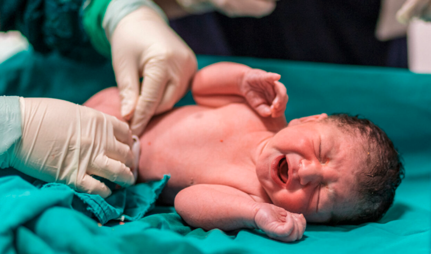 A newborn baby cries on a table. Gloved hands hold its umbilical cord